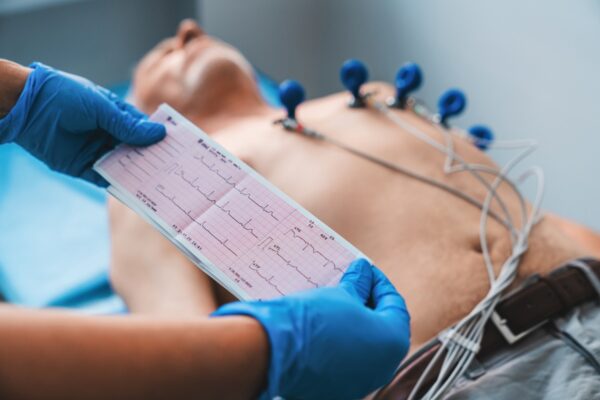 Comprehensive Guide to Echo Test in Bangalore: What You Need to Know Echo Test in Bangalore