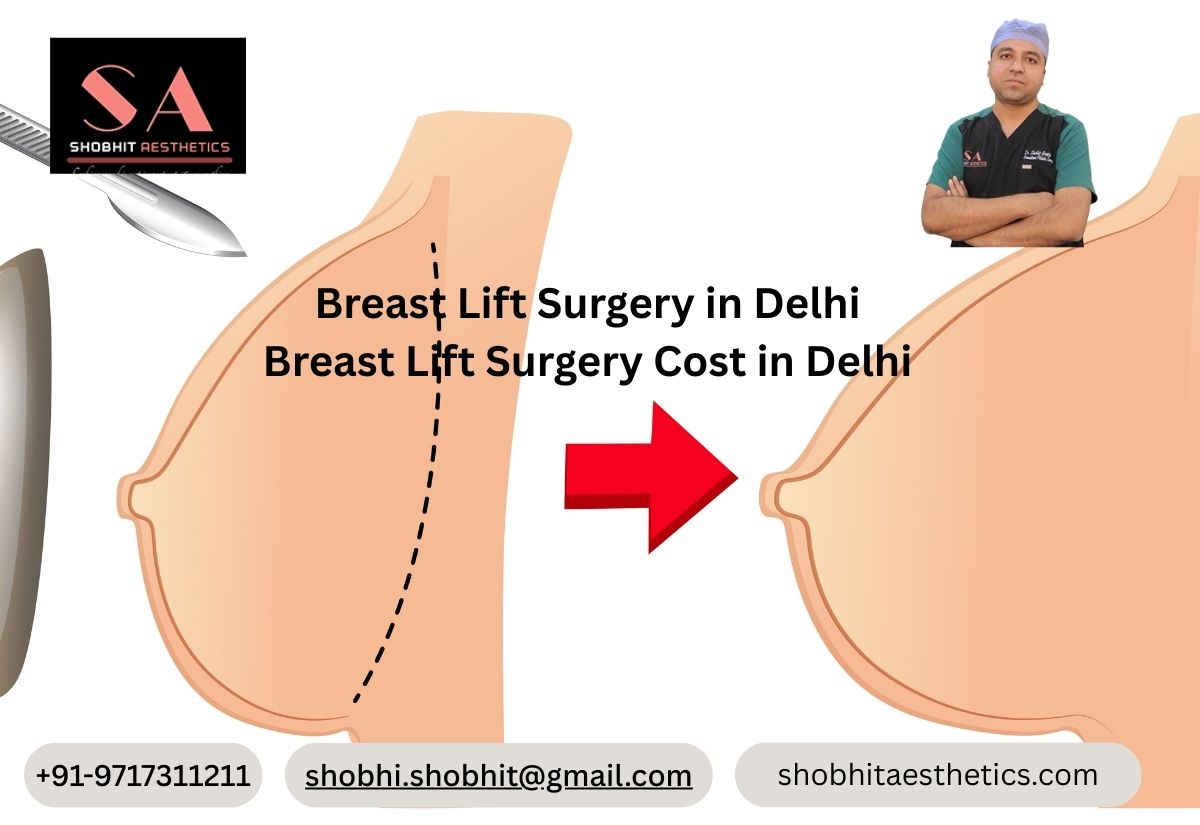 Breast Lift Surgery Cost in Delhi