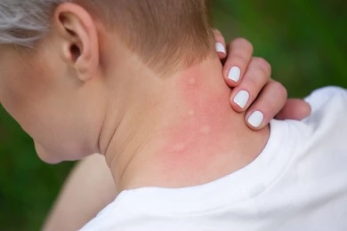 Why Wormiza 1000Mg Is a Trusted Choice for Parasite Infections