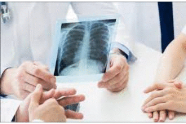 Finding the Nearest X Ray Lab: A Complete Guide for Quick & Reliable Imaging nearest x ray lab